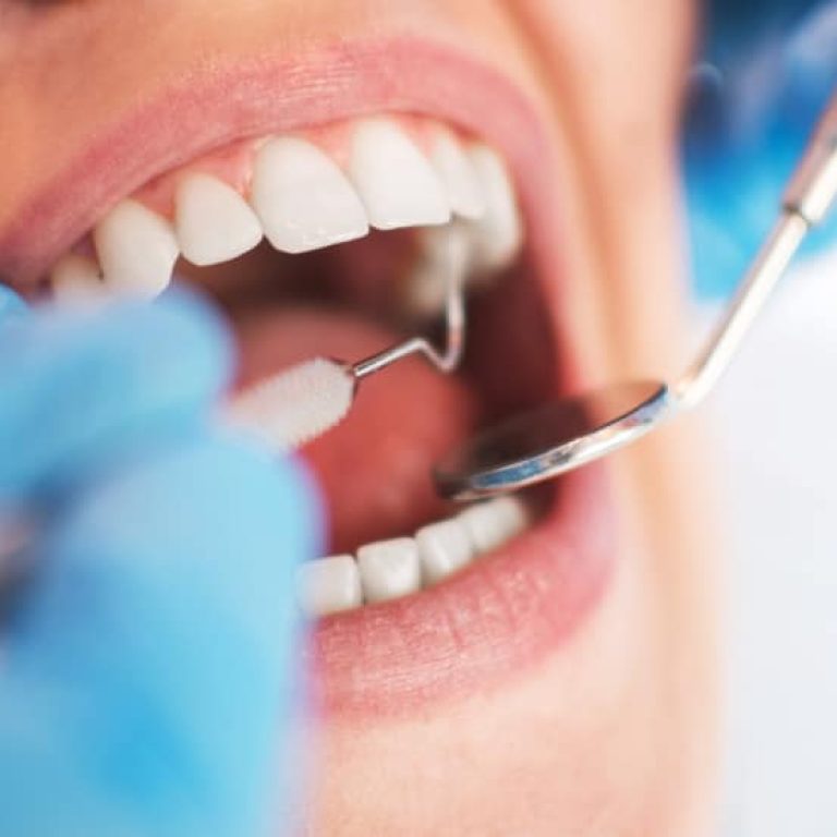 consultation dentaire